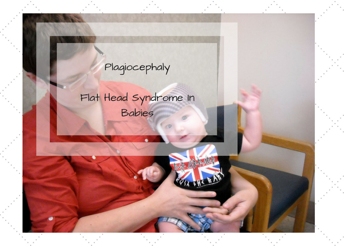 Plagiocephaly-Flat Head Syndrome in Babies