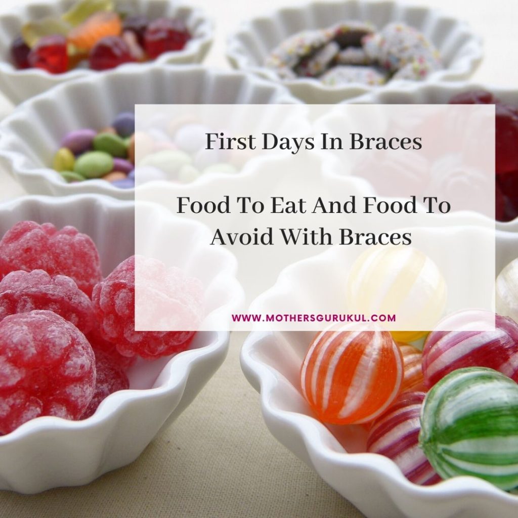 Food to eat and food to avoid with braces